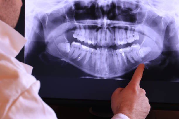 Best Emergency Dental Extractions in Hopkins, SC