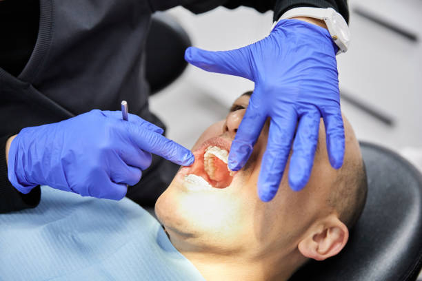 Best Broken or Cracked Tooth Emergency Dentist in Hopkins, SC